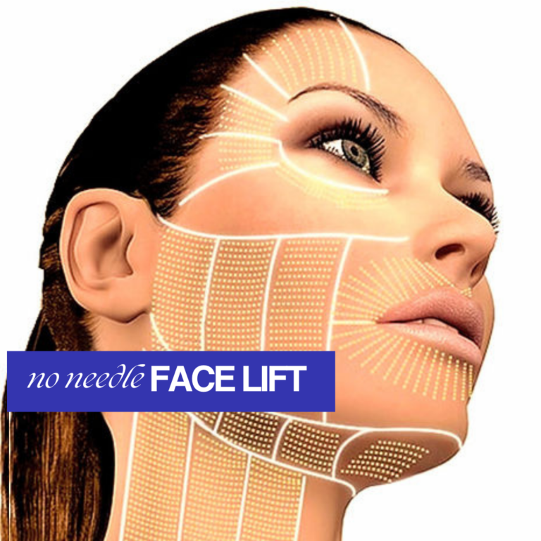 No Needle Face Lift | Meraki Wellness & Med Spa | FL