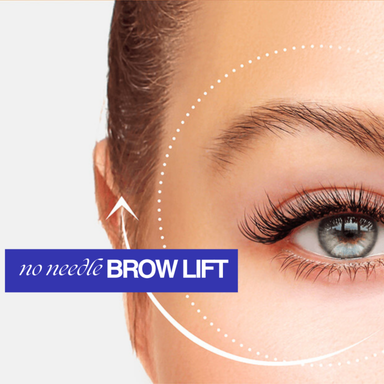 No needle brow lift | Meraki Wellness & Med Spa | FL